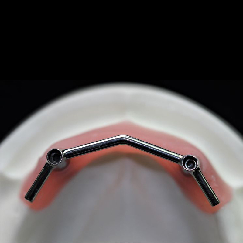 Implantatschiene