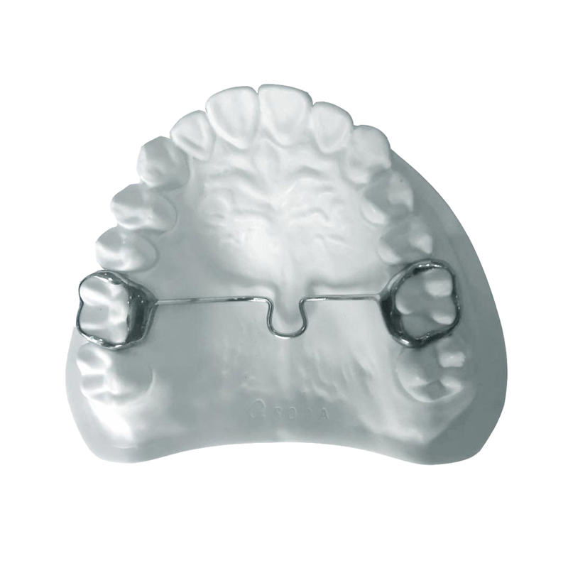 Fester Transpalatinalbogen (TPA)