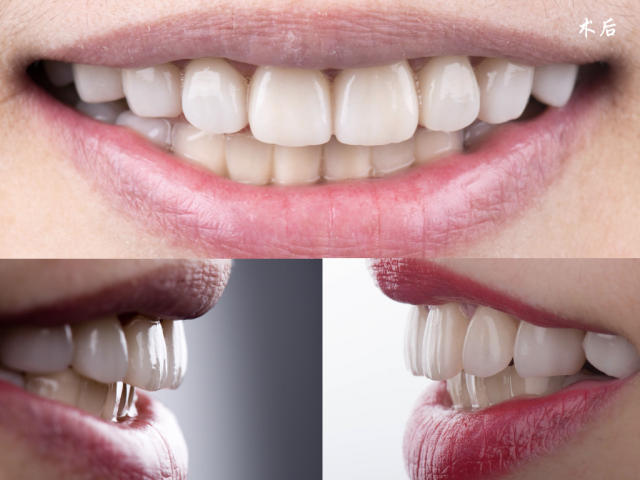 Chinesisches Dentallabor zur Herstellung von Zirkonoxid-Langbrücken