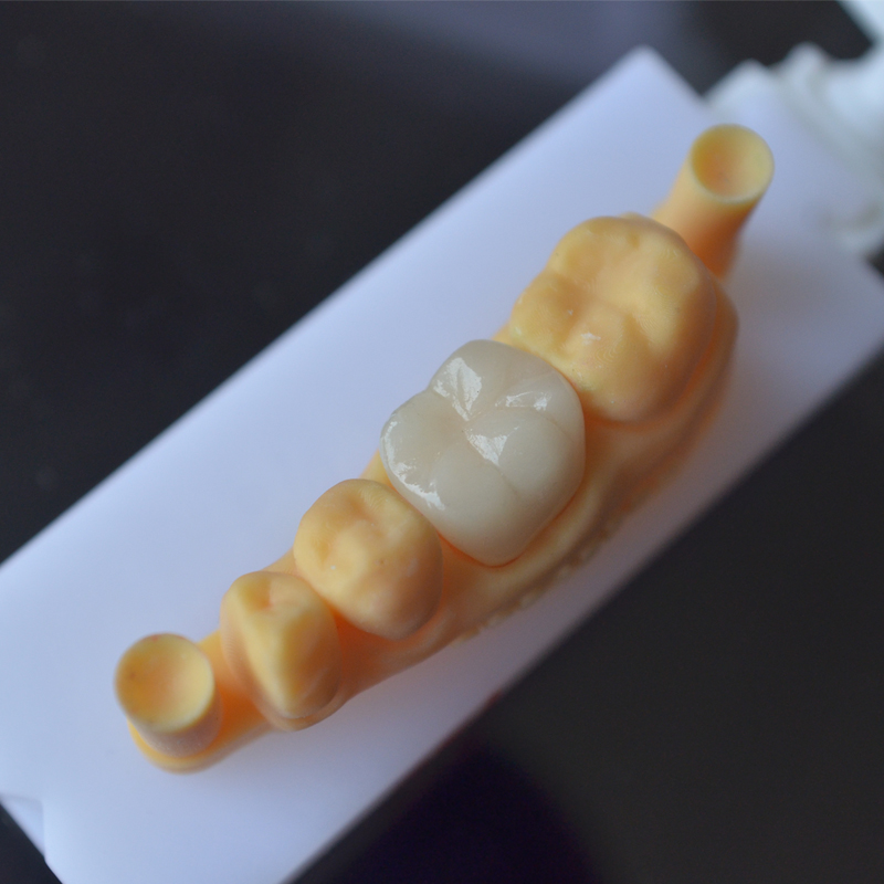 Wie wäre es mit Zähnen aus dem 3D-Druck? Ist die Technologie ausgereift?