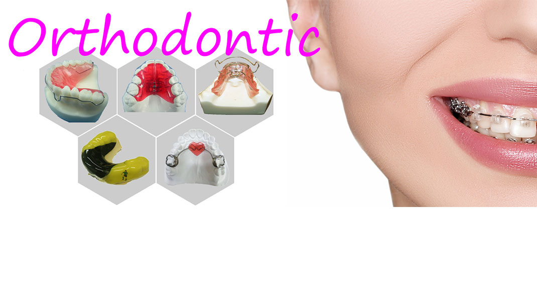Kieferorthopädie