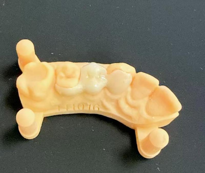 Was müssen Sie über Maryland-Brücken wissen?