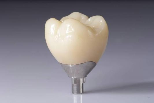 Optimieren Sie Ihre Ergebnisse mit Zirkonoxid-Restaurationen (Kronen, Brücken, Implantate)